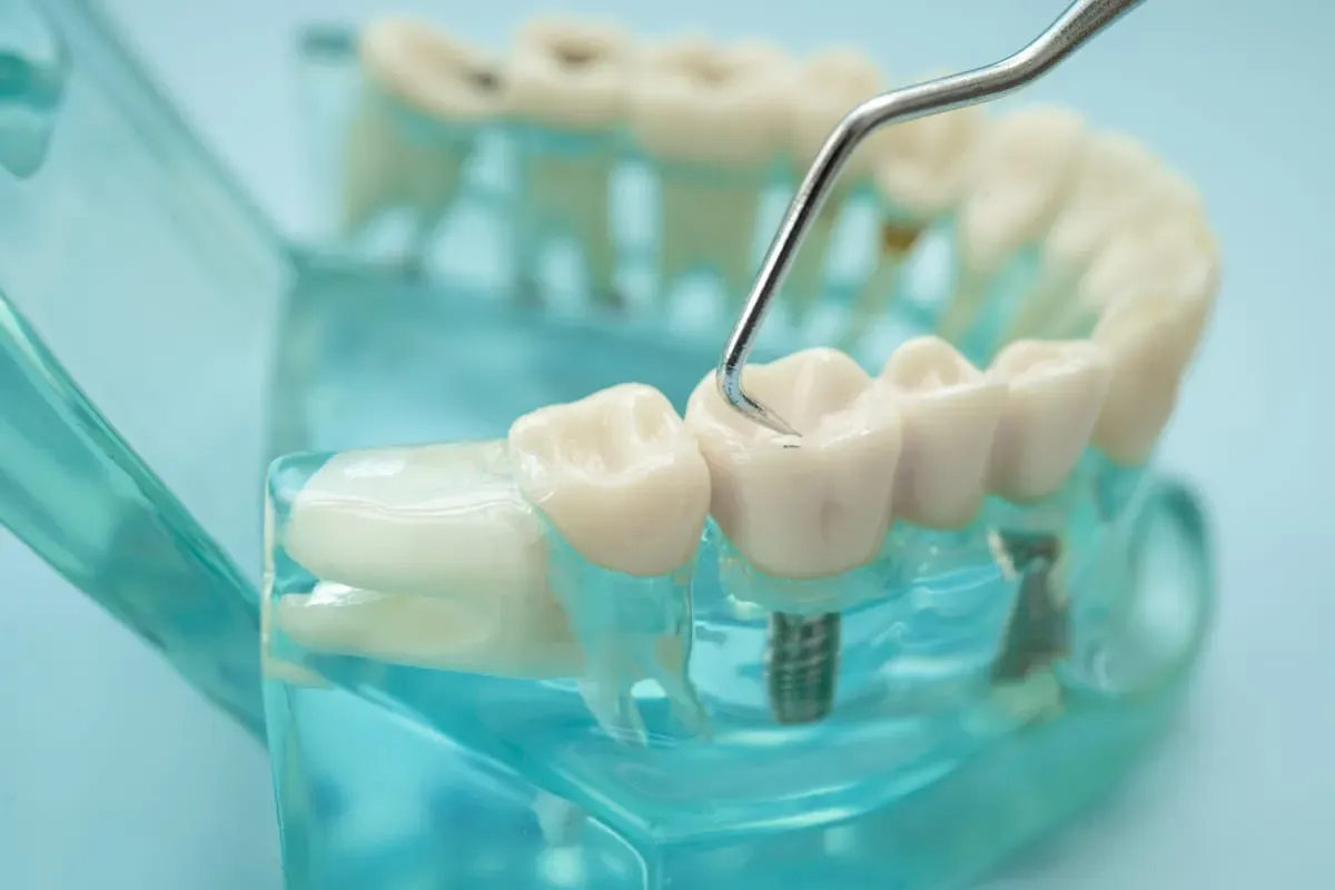 Restorative Dentistry: Restore Your Smile Today
