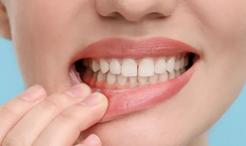 Stop Gum Disease with These 5 Habits