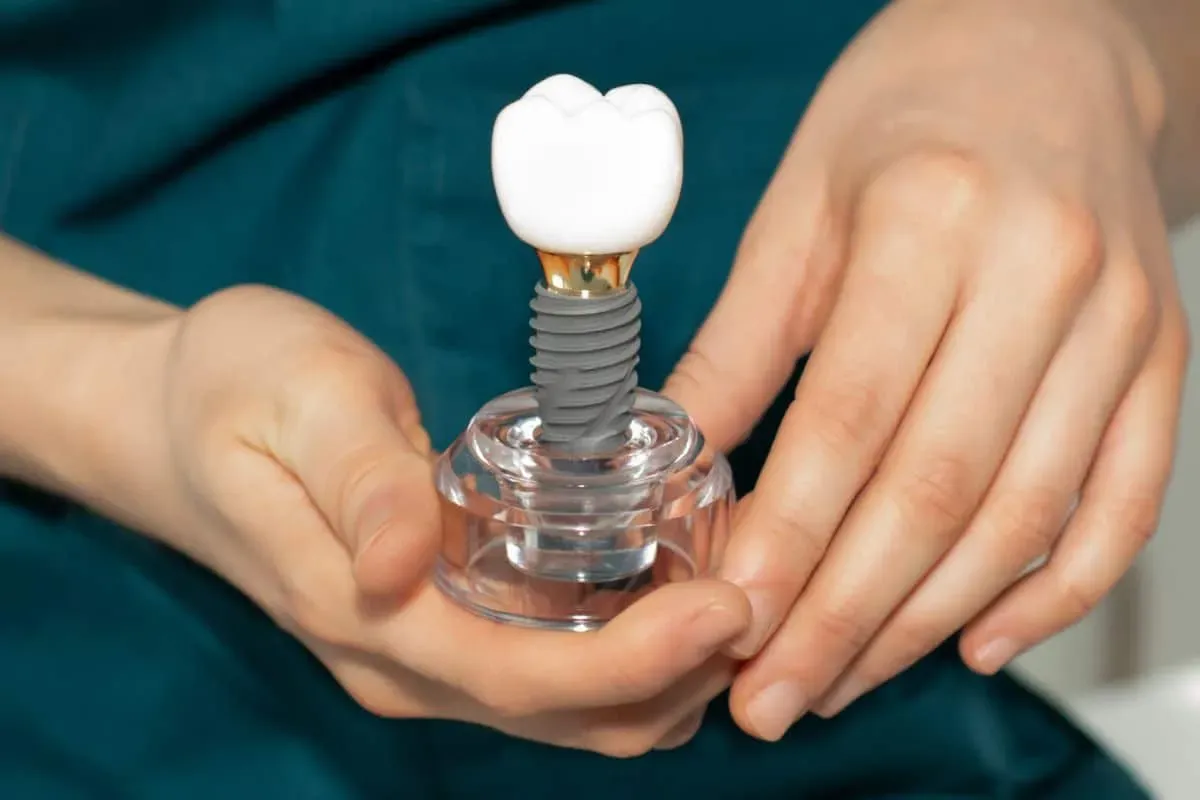 Dental Implants Clarksburg Solution | Urban Dental Studio
