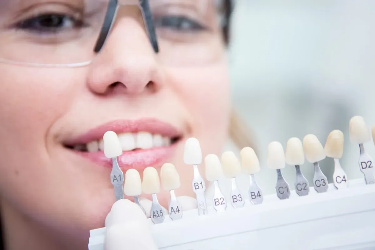 Veneers vs. Bonding in Germantown, MD | Urban Dental Studio